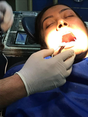 World class instrrument for perfect  & painless root canal treatment